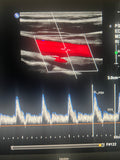carotid review
