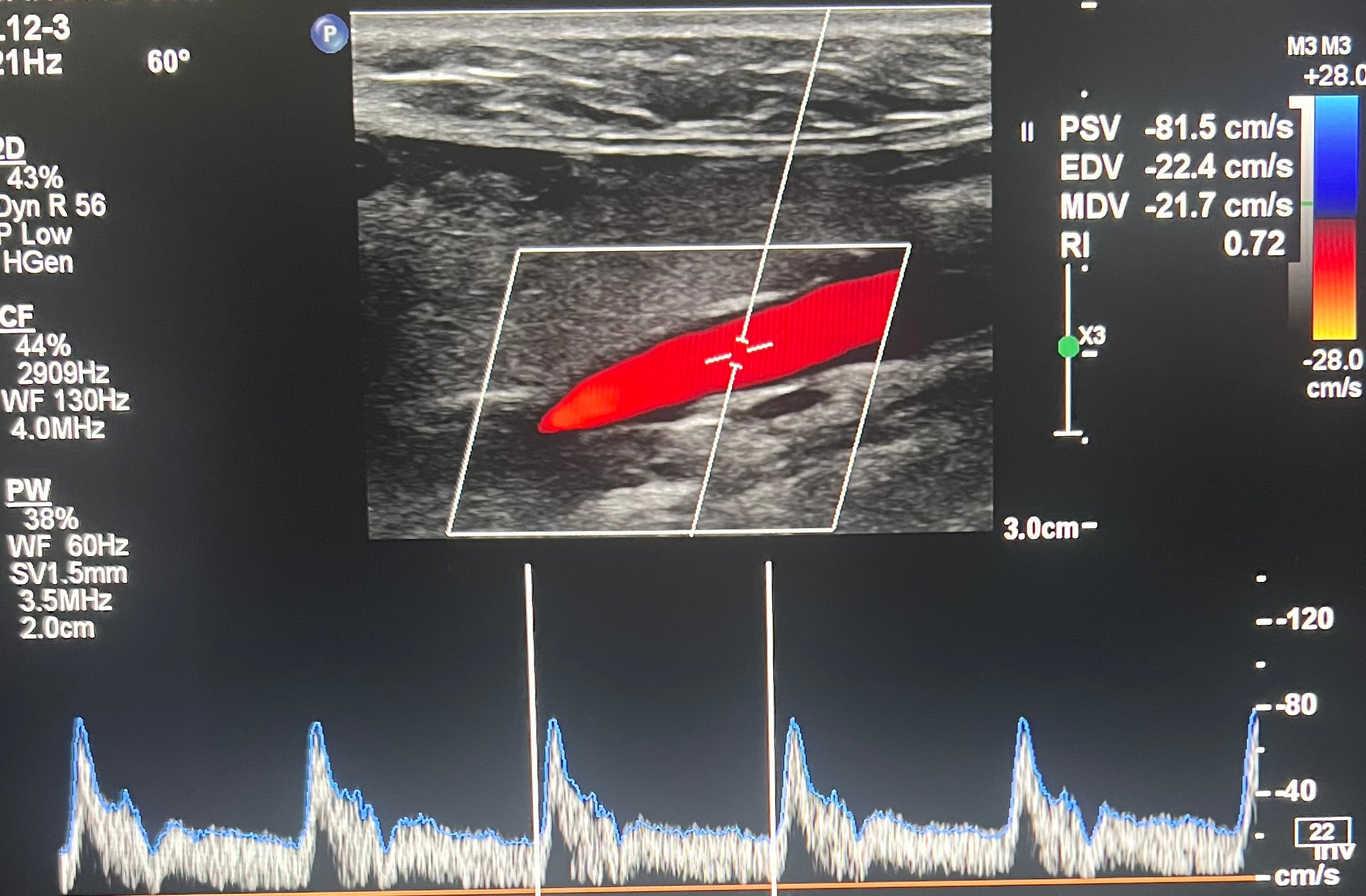 Vascular review