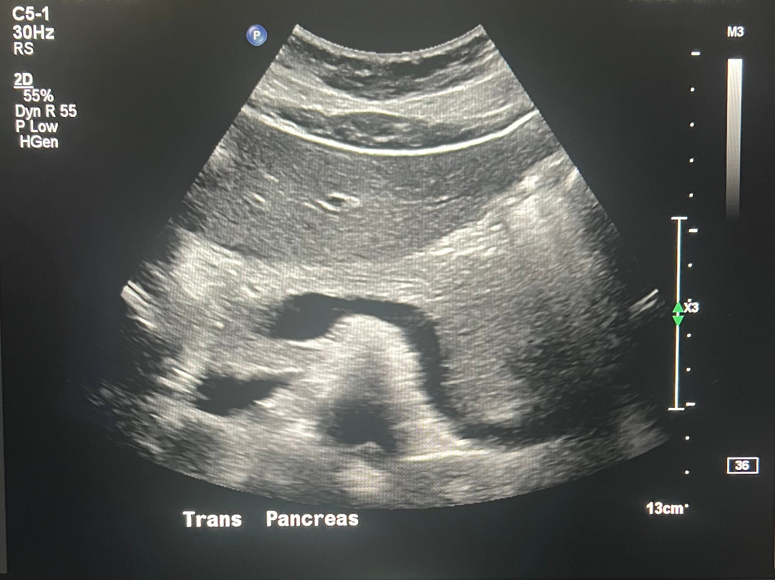 Pancreas review