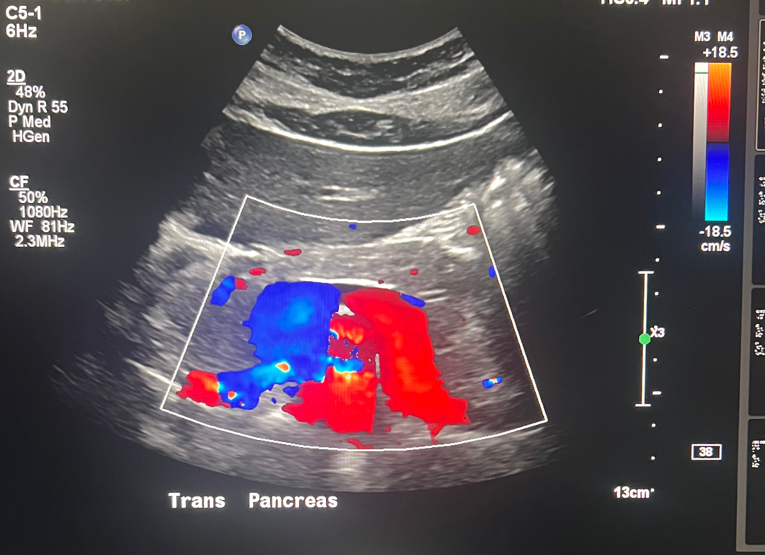 Pancreas review