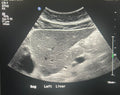 liver review