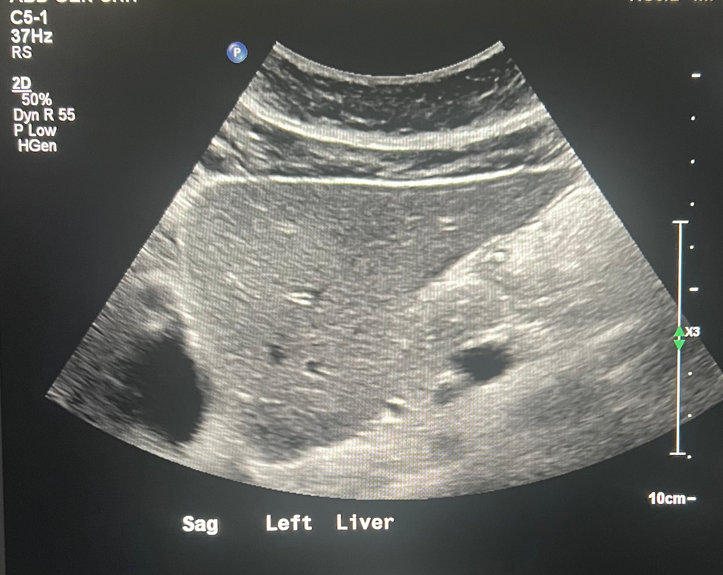 liver review