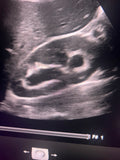 kidney review