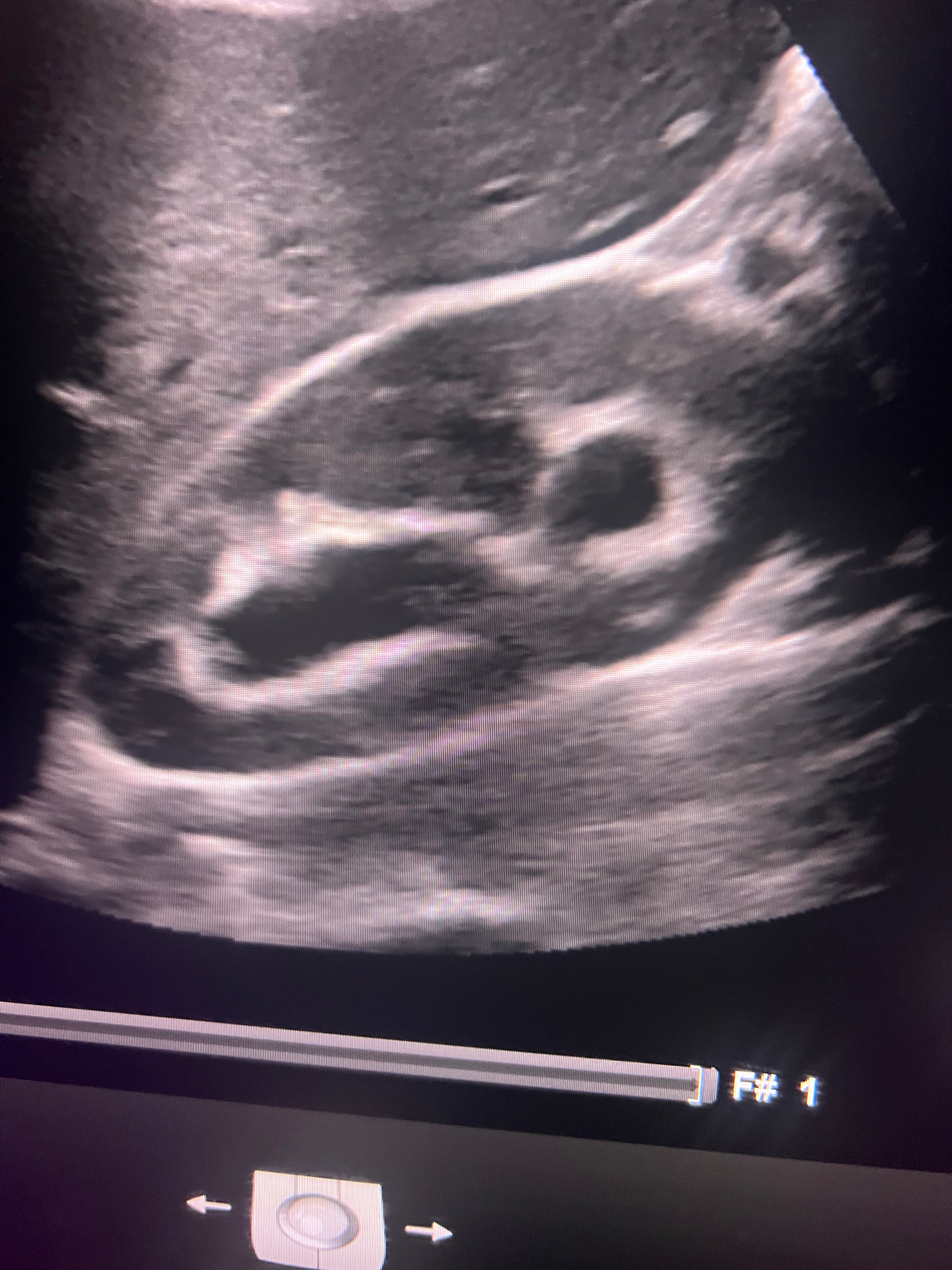 kidney review